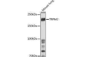 Western blot analysis of extracts of Mouse lung, using TRPM2 antibody (ABIN6128836, ABIN6149582, ABIN6149583 and ABIN6221738) at 1:500 dilution. (TRPM2 antibody  (AA 900-1000))
