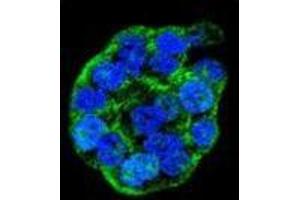 Confocal immunofluorescent analysis of WTIP Antibody (C-term) with WiDr cell followed by Alexa Fluor 488-conjugated goat anti-rabbit lgG (green). (WTIP antibody  (C-Term))