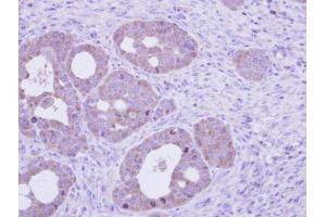 IHC-P Image Immunohistochemical analysis of paraffin-embedded NCIN87 xenograft, using FTCD, antibody at 1:100 dilution. (FTCD antibody)