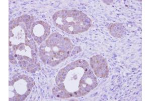IHC-P Image Immunohistochemical analysis of paraffin-embedded NCIN87 xenograft, using FTCD, antibody at 1:100 dilution.