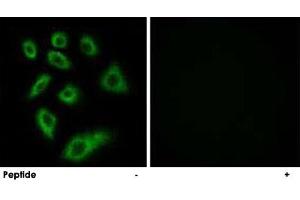Immunofluorescence analysis of HUVEC cells, using CYP2W1 polyclonal antibody . (CYP2W1 antibody)