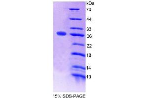 SDS-PAGE analysis of Mouse SNAP23 Protein. (SNAP23 Protein)