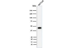 Western Blotting (WB) image for anti-Keratin 18 (KRT18) antibody (ABIN6939931)