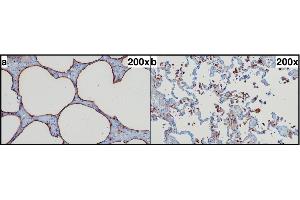 SP-A immunohistochemistry. (Surfactant Protein A1 antibody  (Internal Region))