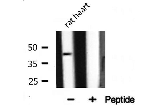 ILKAP antibody  (N-Term)