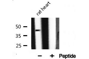 Western blot analysis of extracts from rat liver, using ILKAP antibody.