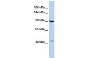 Image no. 1 for anti-Glutamate Receptor Interacting Protein 1 (GRIP1) (AA 950-999) antibody (ABIN6742282) (GRIP1 antibody  (AA 950-999))