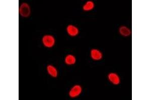 Immunofluorescent analysis of Adenylate Kinase 6 staining in Jurkat cells.