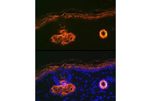 Immunofluorescence analysis of rat skin using Cytokeratin 2e (KRT2) Rabbit mAb (ABIN1680763, ABIN3016322, ABIN3016323 and ABIN7101480) at dilution of 1:100 (40x lens). (Keratin 2 antibody)