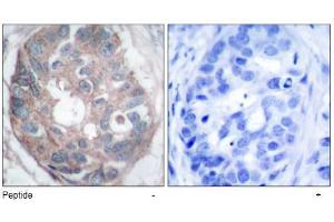 Image no. 1 for anti-Disabled Homolog 1 (Drosophila) (DAB1) (Tyr232) antibody (ABIN197508) (DAB1 antibody  (Tyr232))