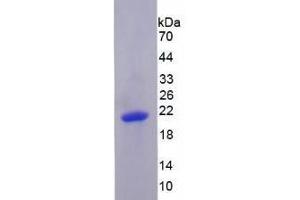 SDS-PAGE analysis of Human PRDM1 Protein.