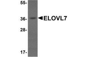 Western blot analysis of ELOVL7 in human liver tissue lysate with AP30312PU-N ELOVL7 antibody at 1 μg/ml. (ELOVL7 antibody  (N-Term))