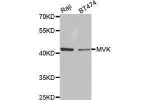 Western blot analysis of extracts of various cell lines, using MVK antibody. (MVK antibody)