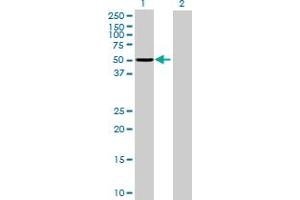 Western Blot analysis of PPP1R12B expression in transfected 293T cell line by PPP1R12B MaxPab polyclonal antibody. (PPP1R12B antibody  (AA 1-386))