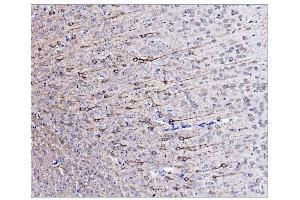 IHC analysis of Alpha Internexin/INA using anti-Alpha Internexin/INA antibody (ABIN7602187).