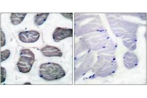 Immunohistochemistry analysis of paraffin-embedded human muscle tissue, using Actin-alpha-1 Antibody. (Actin antibody  (AA 1-50))