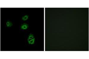 Immunofluorescence analysis of A549 cells, using OR2B2 Antibody. (OR2B2 antibody  (AA 241-290))