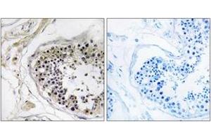 Immunohistochemistry analysis of paraffin-embedded human testis tissue, using CST8 Antibody.