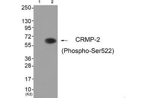 Western blot analysis of extracts from HuvEc cells (Lane 2), using CRMP-2 (Phospho-Ser522) Antibody. (DPYSL2 antibody  (pSer522))