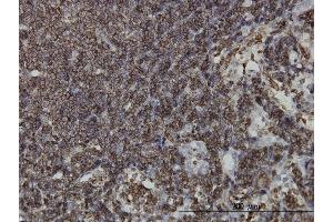 Immunoperoxidase of monoclonal antibody to HCLS1 on formalin-fixed paraffin-embedded human lymph node. (HCLS1 antibody  (AA 266-355))