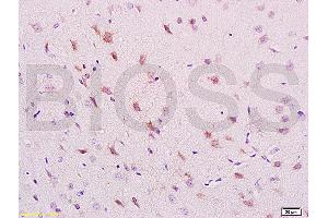 Formalin-fixed and paraffin embedded rat brain labeled with Anti-phospho-NRP1(Thr916) Polyclonal Antibody, Unconjugated (ABIN710756) at 1:200 followed by conjugation to the secondary antibody and DAB staining. (Neuropilin 1 antibody  (pThr916))