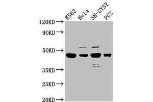 Western Blot Positive WB detected in: K562 whole cell lysate, Hela whole cell lysate, SH-SY5Y whole cell lysate, PC-3 whole cell lysate All lanes: LYAR antibody at 2. (LYAR antibody  (AA 1-379))