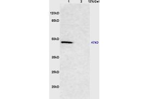 Lane 1: mouse brain lysates Lane 2: mouse kidney lysates probed with Anti Smad3 Polyclonal Antibody, Unconjugated (ABIN747023) at 1:200 in 4 °C. (Smad2/3 antibody  (AA 30-80))
