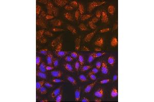 Immunofluorescence analysis of U-2 OS cells using Versican Rabbit mAb (ABIN7271309) at dilution of 1:100 (40x lens). (Versican antibody)