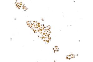 Immunocytochemistry (ICC) image for anti-Paired Box 8 (PAX8) (AA 225-275) antibody (ABIN7795777) (Recombinant PAX8 antibody  (AA 225-275))