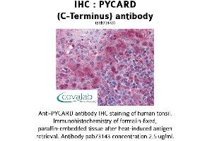 Image no. 2 for anti-PYD and CARD Domain Containing (PYCARD) (C-Term) antibody (ABIN1738638) (PYCARD antibody  (C-Term))