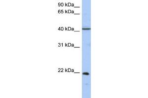WB Suggested Anti-GUK1 Antibody Titration: 0.