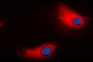 Immunofluorescent analysis of ATP1A1 staining in HeLa cells. (ATP1A1 antibody  (N-Term))