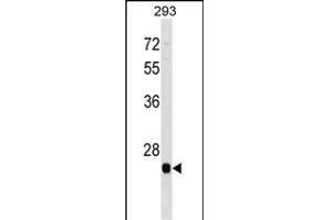 BTG4 Antibody (C-term) (ABIN1536722 and ABIN2849975) western blot analysis in 293 cell line lysates (35 μg/lane). (BTG4 antibody  (C-Term))