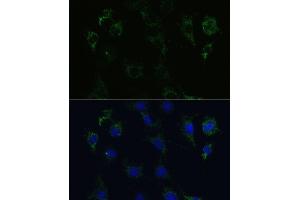 Immunofluorescence analysis of C6 cells using STX1A Polyclonal Antibody (ABIN6132695, ABIN6148659, ABIN6148661 and ABIN6221218) at dilution of 1:100 (40x lens). (STX1A antibody  (AA 1-288))