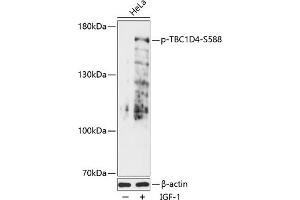 Western blot analysis of extracts of HeLa cells, using Phospho-TBC1D4-S588 antibody (ABIN7270747) at 1:2000 dilution. (TBC1D4 antibody  (pSer588))