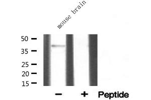 Western blot analysis of extracts from mouse brian, using SGCA antibody. (SGCA antibody  (Internal Region))