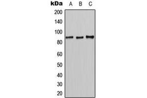 Western blot analysis of CLCN7 expression in HeLa (A), mouse liver (B), rat liver (C) whole cell lysates. (CLCN7 antibody  (N-Term))
