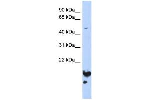 WB Suggested Anti-NUSAP1 Antibody Titration:  0. (NUSAP1 antibody  (Middle Region))
