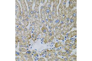 Immunohistochemistry of paraffin-embedded human liver injury using EPO antibody. (EPO antibody)