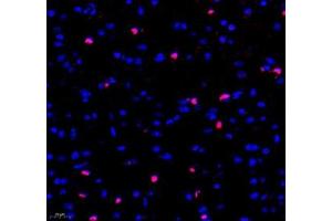 Immunofluorescence of paraffin embedded mouse brain using Adenosine kinase (ABIN7072953) at dilution of 1: 300 (400x lens)