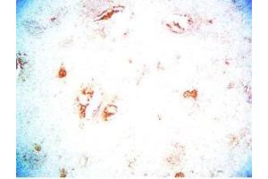 Rat brain tissue was stained by Rabbit Anti-CB2 Receptor (323-360) Serum (CNR2 antibody  (AA 323-360))