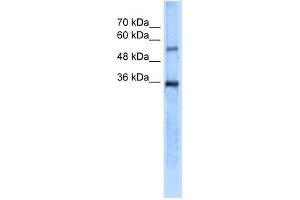 Carbonic Anhydrase VIII antibody used at 5 ug/ml to detect target protein. (CA8 antibody  (N-Term))
