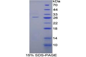 SDS-PAGE analysis of Mouse SHC2 Protein.