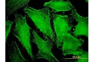 Immunofluorescence of monoclonal antibody to CDC42BPB on HeLa cell. (CDC42BPB antibody  (AA 1580-1679))