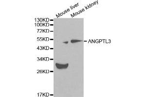 Western blot analysis of extracts of various cell lines, using ANGPTL3 antibody (ABIN5970263) at 1/1000 dilution. (ANGPTL3 antibody)