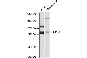 Western blot analysis of extracts of various cell lines, using NPR3 antibody (ABIN6133449, ABIN6144785, ABIN6144786 and ABIN6224163) at 1:1000 dilution. (NPR3 antibody  (AA 272-541))