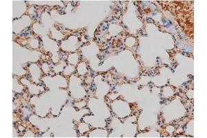 Immunohistochemistry (IHC) image for anti-Filamin A, alpha (FLNA) (pSer2152) antibody (ABIN6256196)