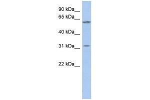 C1ORF110 antibody used at 1 ug/ml to detect target protein. (C1ORF110 antibody  (Middle Region))