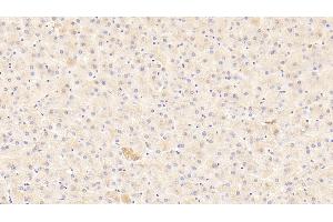 Immunohistochemistry (IHC) image for anti-Autocrine Motility Factor Receptor (AMFR) (AA 456-643) antibody (ABIN7444268)