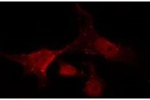 ABIN6266924 staining HuvEc by IF/ICC. (NRF2 antibody  (N-Term))